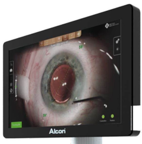 Alcon社 Verion® 手術室内モニター